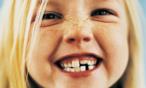 سبب غريب يجعلكِ تحتفظين بأسنان اطفالكِ !
