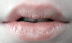 هل تعانين من تشقق الشفاه في الشتاء؟ إليكِ الحل