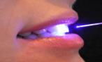 تعانين من مشاكل الاسنان؟ربما الليزر هو الحل!