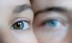 إلامَ يرمز ظهور بقع في حدقة العين؟ السبب غريب!