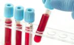 مفاجأة: فحص دم جديد يمكنه الكشف عن جميع أمراض القلب الوراثية